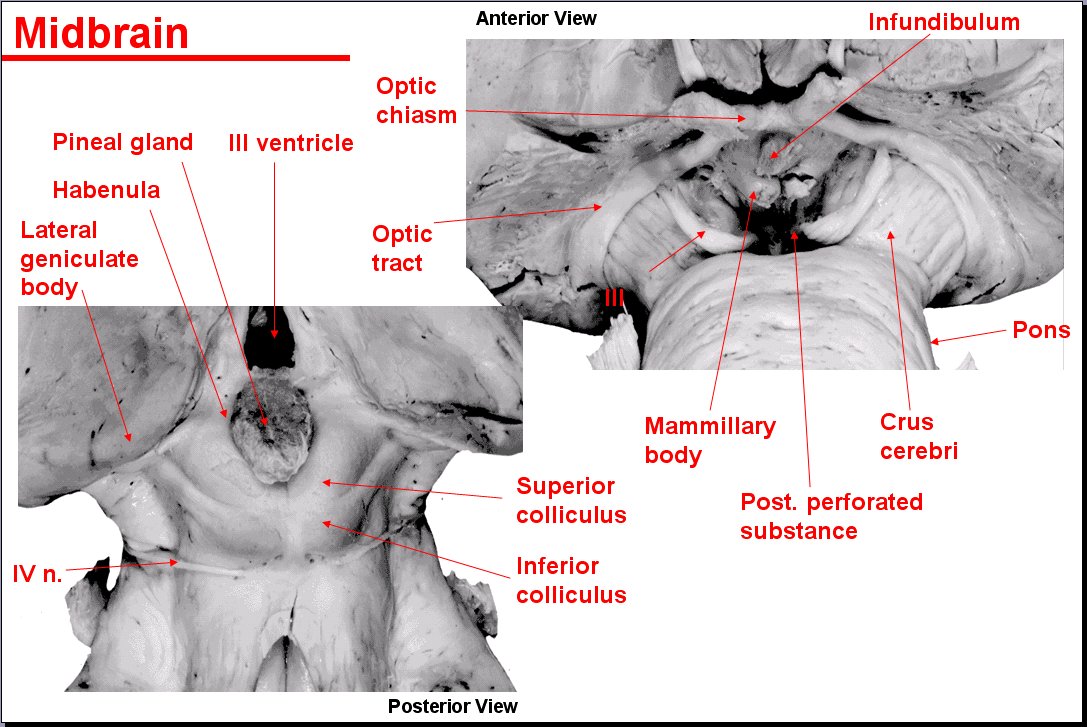 Salamons Neuroanatomy And Neurovasculature Web Atlas Resource